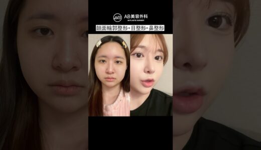目鼻輪郭フル整形の真実 | AB美容整形
