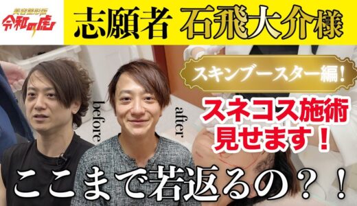 【美容整形版 令和の虎】ここまで若返るの？！【スキンブースター編】