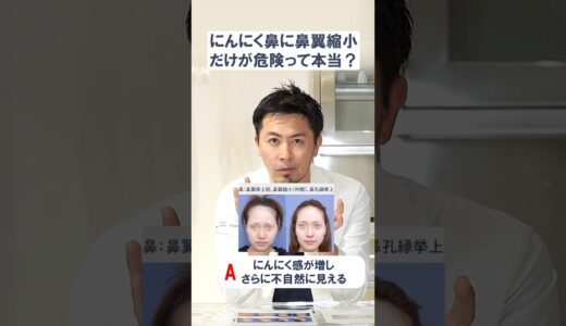 にんにく鼻に鼻翼縮小だけって危険なの？#鼻整形#整形 #美容整形#美容クリニック#プロテーゼ#鼻中隔延長 #美容