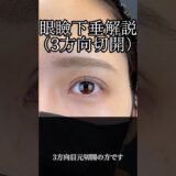 眼瞼下垂解説(3方向切開) #二重整形 #美容整形