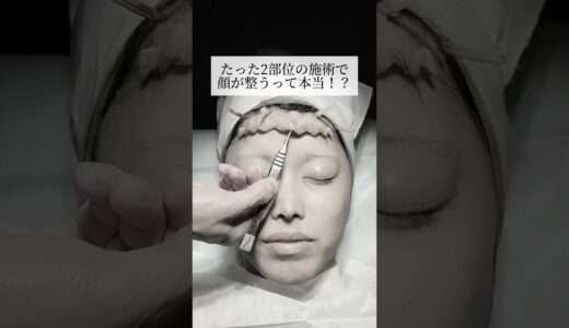 【鼻整形】2部位の施術で顔が整うって本当！？#shorts