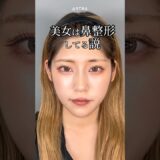 【美女は鼻整形してる説🤫#忘れ鼻#鼻整形#鼻尖形成#耳介軟骨移植#鼻プロテーゼ#小鼻縮小#美容整形#塩満先生#アストラビューティークリニック#astrabeautyclinic#渋谷】
