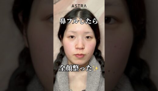 フル整形で全顔整う👩🏼‍⚕️💖#astrabeautyclinic  #アストラビューティークリニック #塩満恵子 #鼻整形 #美容整形 #忘れ鼻