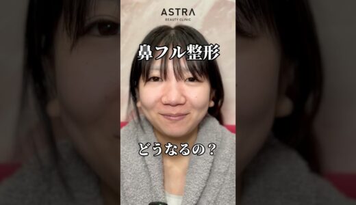 鼻フルでどう変わる？😧🩵#astrabeautyclinic  #アストラビューティークリニック #塩満恵子 #鼻整形 #美容整形 #忘れ鼻