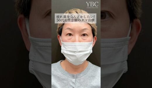 疲れ顔をなんとかしたい！#クマ取り #目の下のクマ #目の下のたるみ取り #整形 #整形外科 #美容 #美容整形 #老化防止 #健康 #垢抜け #若返り美容