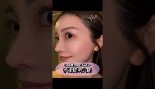 全身整形800万超えの手術箇所一覧#美容整形 #整形 #美容 #スキンケア #コスメ #ダイエット#鼻整形#埋没#シリコン豊胸#豊胸