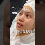 【ファッションショーに出るために…決意の鼻整形】 #整形 #美容 #鼻整形 #shorts #shortvideo