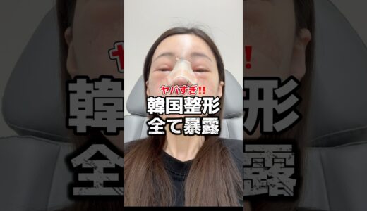 ヤバすぎ‼️韓国整形全て暴露 #韓国 #韓国旅行 #韓国旅行情報 #渡韓 #渡韓情報 #ソウル #ソウル旅行 #韓国美容 #short #shorts