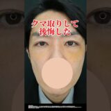 クマ取りして後悔した　#湘南美容クリニック船橋院　#クマ取り #クマ取りといえば大野 #湘南美容クリニック #美容 #整形　#shorts