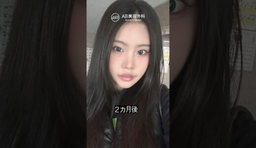 韓国整形で劇的変化！輪郭手術ビフォーアフター | AB美容整形