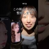 【二重整形】この顔になるために整形します　#shorts