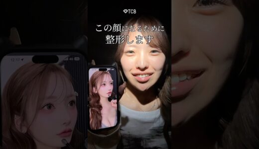 【二重整形】この顔になるために整形します　#shorts