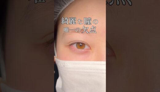 【目元整形】アースアイの唯一の欠点とは？#shorts