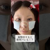 【鼻整形】鼻整形すると絶対バレる！？#shorts
