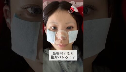 【鼻整形】鼻整形すると絶対バレる！？#shorts
