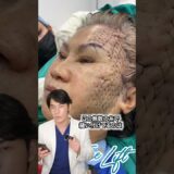 整形失敗…? やばいフェイスリフト #shorts