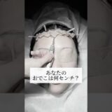 【整形】あなたのおでこは何センチ？#shorts