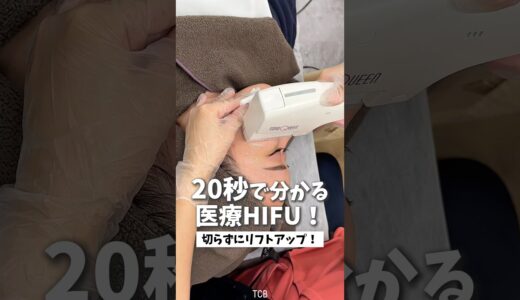 【美容整形】20秒で分かる医療HIFU🌟#shorts