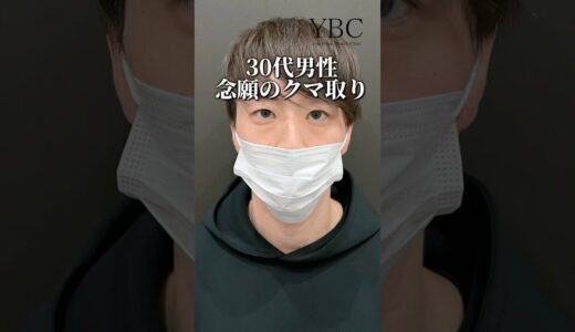 30代男性クマ治療#クマ取り #クマ治療 #美容整形 #美容