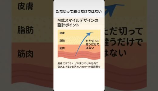 たった4mm~ 　印象は変わる‼️ #美容整形 #くさのたろうクリニック #口角 挙上