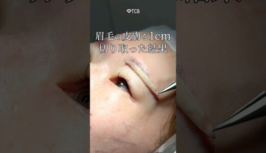 【眉下リフト】眉毛の皮膚を… #shorts