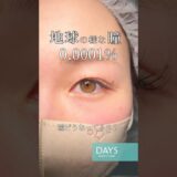 【二重整形】綺麗な瞳を活かした二重に#shorts