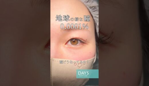 【二重整形】綺麗な瞳を活かした二重に#shorts