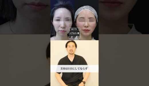 【美容整形の匠】劇的ビフォーアフター！この患者様はなんと…！　#shorts
