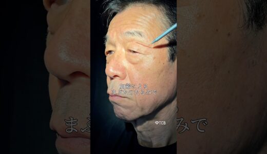 【美容整形】眉下の皮膚を切ると…#shorts