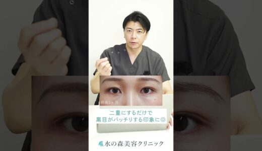 目の開きが悪い人の最適な治療は？#shorts #水の森美容クリニック #美容整形 #眼瞼下垂＃二重整形