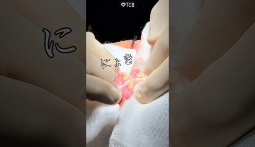 【クマ取り】にょきっ！にょきっ！にょきっ！#shorts