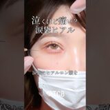 【美容整形】泣くほど痛い？涙袋ヒアル💧#shorts