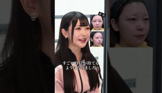 アイドルの整形アップデート #shorts #美容整形 #ビフォーアフター