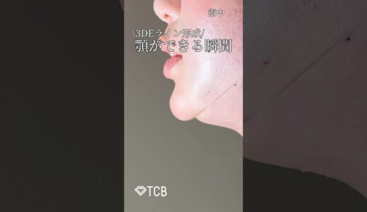 【3DEライン】顎が出来る瞬間#shorts