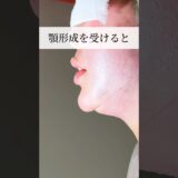 【美容整形】顎形成受けたら…#shorts
