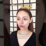 進撃のノアさんの美容施術を担当させていただきました💉