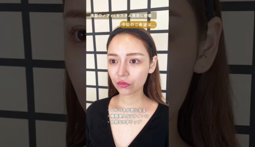 進撃のノアさんの美容施術を担当させていただきました💉