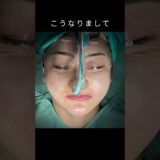 20代口ゴボレポ様の骨切り術後１週間まで#shorts