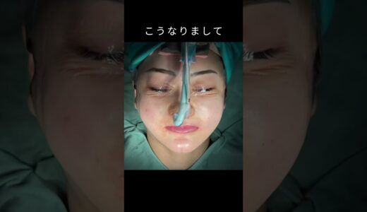 20代口ゴボレポ様の骨切り術後１週間まで#shorts