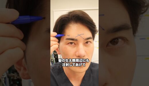額のヒアルロン酸ここだけに入れないで❌ #shorts