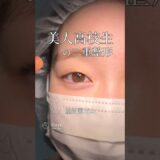 【二重整形】高校生で二重整形、あり？なし？#shorts
