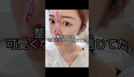 整形すれば可愛くなれると信じてた。#美容整形 #美容 #整形 #スキンケア #コスメ