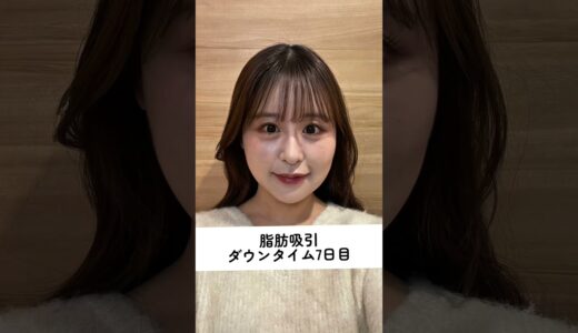 別人級に垢抜けました🪄🤍 #美容 #整形 #ダウンタイム #脂肪吸引