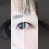 #湘南美容クリニック名古屋院 #美容 #美容整形 #二重埋没 #埋没二重 #自然癒着セット #自然癒着法　#垢抜け
