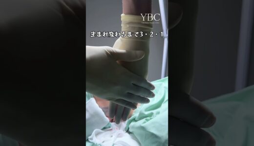 顎下脂肪吸引で生まれ変わる‼️#脂肪吸引 #美容整形 #おすすめ