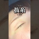 抜糸の瞬間👀 #形成外科専門医 #二重整形