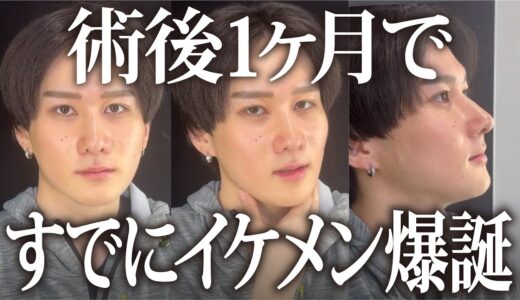 【美容整形版 令和の虎】両顎手術後のたるみを解消させます。