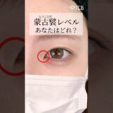 【美容整形】蒙古襞レベルあなたはどれ？#shorts