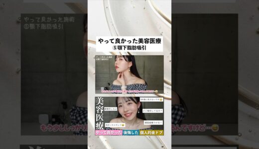【やって良かった美容医療⑤顎下脂肪吸引編】#美容医療#美容#脱毛#脂肪吸引#輪郭#糸リフト#アラサー#30代#肌管理#プチ整形#美容クリニック
