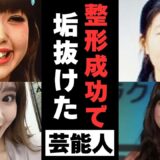 【有益2ch】決め手は引き算！美容整形が大成功して垢抜けた芸能人【ガルちゃん】